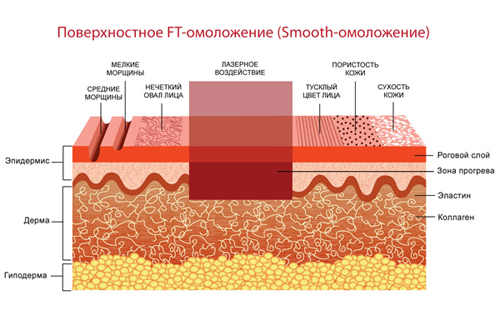 smooth омоложение