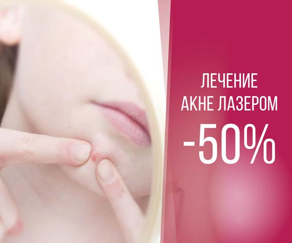 Эту процедуру вы еще не пробовали! Лечение акне лазером -50%