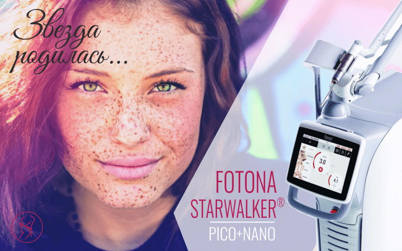 Звезда родилась… Fotona StarWalker®